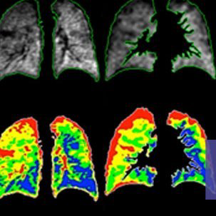 Article's Main Image
